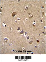 TTC9B Antibody (C-term) (Cat. #AP11588b)immunohistochemistry analysis in formalin fixed and paraffin embedded human brain tissue followed by peroxidase conjugation of the secondary antibody and DAB staining.This data demonstrates the use of TTC9B Antibody (C-term) for immunohistochemistry. Clinical relevance has not been evaluated.