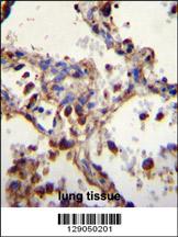 WDR52 Antibody (C-term) (Cat. #AP11586b)immunohistochemistry analysis in formalin fixed and paraffin embedded human lung tissue followed by peroxidase conjugation of the secondary antibody and DAB staining.This data demonstrates the use of WDR52 Antibody (C-term) for immunohistochemistry. Clinical relevance has not been evaluated.