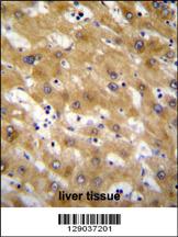 CLEC12B Antibody (C-term) (Cat. #AP11585b)immunohistochemistry analysis in formalin fixed and paraffin embedded human liver tissue followed by peroxidase conjugation of the secondary antibody and DAB staining.This data demonstrates the use of CLEC12B Antibody (C-term) for immunohistochemistry. Clinical relevance has not been evaluated.