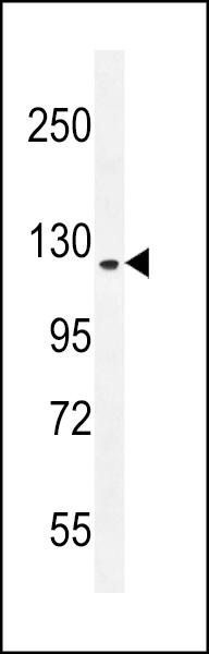 RUTBC1 Antibody (C-term) (Cat. #AP11573b) western blot analysis in mouse NIH-3T3 cell line lysates (35ug/lane).This demonstrates the RUTBC1 antibody detected the RUTBC1 protein (arrow).