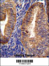 RUTBC1 Antibody (C-term) (Cat. #AP11573b)immunohistochemistry analysis in formalin fixed and paraffin embedded human uterus tissue followed by peroxidase conjugation of the secondary antibody and DAB staining.This data demonstrates the use of RUTBC1 Antibody (C-term) for immunohistochemistry. Clinical relevance has not been evaluated.