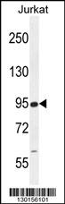 RSBN1 Antibody (N-term) (Cat. #AP11537a) western blot analysis in Jurkat cell line lysates (35ug/lane).This demonstrates the RSBN1 antibody detected the RSBN1 protein (arrow).