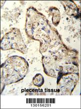 RSBN1 Antibody (N-term) (Cat. #AP11537a)immunohistochemistry analysis in formalin fixed and paraffin embedded human plecenta tissue followed by peroxidase conjugation of the secondary antibody and DAB staining.This data demonstrates the use of RSBN1 Antibody (N-term) for immunohistochemistry. Clinical relevance has not been evaluated.