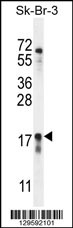 CA115 Antibody (Center) (Cat. #AP11526c) western blot analysis in SK-BR-3 cell line lysates (35ug/lane).This demonstrates the CA115 antibody detected the CA115 protein (arrow).