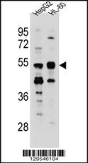 TEKT5 Antibody (Center) (Cat. #AP11523c) western blot analysis in HepG2,HL-60 cell line lysates (35ug/lane).This demonstrates the TEKT5 antibody detected the TEKT5 protein (arrow).