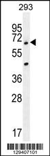 ANKRD34B Antibody (C-term) (Cat. #AP11509b) western blot analysis in 293 cell line lysates (35ug/lane).This demonstrates the ANKRD34B antibody detected the ANKRD34B protein (arrow).