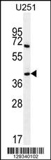 PRR16 Antibody (C-term) (Cat. #AP11498b) western blot analysis in U251 cell line lysates (35ug/lane).This demonstrates the PRR16 antibody detected the PRR16 protein (arrow).
