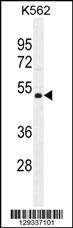 NUDT19 Antibody (Center) (Cat. #AP11496c) western blot analysis in K562 cell line lysates (35ug/lane).This demonstrates the NUDT19 antibody detected the NUDT19 protein (arrow).