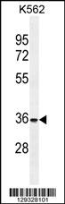 FOXI3 Antibody (Center) (Cat. #AP11492c) western blot analysis in K562 cell line lysates (35ug/lane).This demonstrates the FOXI3 antibody detected the FOXI3 protein (arrow).