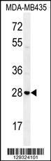 STX19 Antibody (C-term) (Cat. #AP11490b) western blot analysis in MDA-MB435 cell line lysates (35ug/lane).This demonstrates the STX19 antibody detected the STX19 protein (arrow).