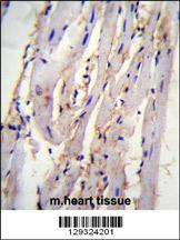 STX19 Antibody (C-term) (Cat. #AP11490b)immunohistochemistry analysis in formalin fixed and paraffin embedded m.heart tissue followed by peroxidase conjugation of the secondary antibody and DAB staining.This data demonstrates the use of STX19 Antibody (C-term) for immunohistochemistry. Clinical relevance has not been evaluated.