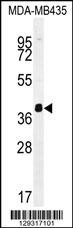 HNRNPCL1 Antibody (C-term) (Cat. #AP11488b) western blot analysis in MDA-MB435 cell line lysates (35ug/lane).This demonstrates the HNRNPCL1 antibody detected the HNRNPCL1 protein (arrow).