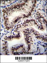 HNRNPCL1 Antibody (C-term) (Cat. #AP11488b)immunohistochemistry analysis in formalin fixed and paraffin embedded human uterus tissue followed by peroxidase conjugation of the secondary antibody and DAB staining.This data demonstrates the use of HNRNPCL1 Antibody (C-term) for immunohistochemistry. Clinical relevance has not been evaluated.