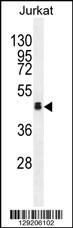 OR4N4 Antibody (N-term) (Cat. #AP11476a) western blot analysis in Jurkat cell line lysates (35ug/lane).This demonstrates the OR4N4 antibody detected the OR4N4 protein (arrow).