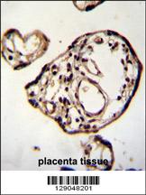 PM20D2 Antibody (C-term) (Cat. #AP11466b)immunohistochemistry analysis in formalin fixed and paraffin embedded human placenta tissue followed by peroxidase conjugation of the secondary antibody and DAB staining.This data demonstrates the use of PM20D2 Antibody (C-term) for immunohistochemistry. Clinical relevance has not been evaluated.