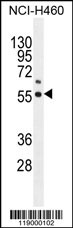 COQ6 Antibody (N-term) (Cat. #AP11456a) western blot analysis in NCI-H460 cell line lysates (35ug/lane).This demonstrates the COQ6 antibody detected the COQ6 protein (arrow).