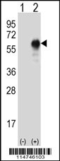 Western blot analysis of LZP (arrow) using rabbit polyclonal LZP Antibody (Cat. #AP11447a). 293 cell lysates (2 ug/lane) either nontransfected (Lane 1) or transiently transfected (Lane 2) with the LZP gene.