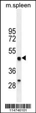 LZP Antibody (Cat. #AP11447a) western blot analysis in mouse spleen tissue lysates (35ug/lane).This demonstrates the LZP antibody detected the LZP protein (arrow).