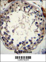 STRA8 Antibody (C-term) (Cat. #AP11436b)immunohistochemistry analysis in formalin fixed and paraffin embedded human testis tissue followed by peroxidase conjugation of the secondary antibody and DAB staining.This data demonstrates the use of STRA8 Antibody (C-term) for immunohistochemistry. Clinical relevance has not been evaluated.