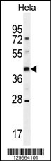 OR10H4 Antibody (C-term) (Cat. #AP11430b) western blot analysis in Hela cell line lysates (35ug/lane).This demonstrates the OR10H4 antibody detected the OR10H4 protein (arrow).