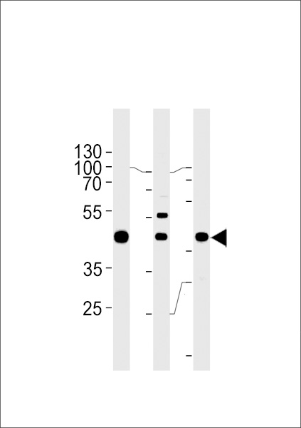 GTF2H2C Antibody(C-term) (Cat.# AP11425b) western blot analysis in A549,K562,MCF-7 cell line lysates (35ug/lane).This demonstrates the GTF2H2C antibody detected the GTF2H2C protein (arrow).