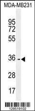 OR10Z1 Antibody (C-term) (Cat. #AP11424b) western blot analysis in MDA-MB231 cell line lysates (35ug/lane).This demonstrates the OR10Z1 antibody detected the OR10Z1 protein (arrow).