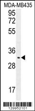 OR4K2 Antibody (C-term) (Cat. #AP11922b) western blot analysis in MDA-MB435 cell line lysates (35ug/lane).This demonstrates the OR4K2 antibody detected the OR4K2 protein (arrow).