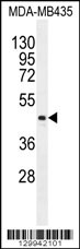 LIPK Antibody (C-term) (Cat. #AP11919b) western blot analysis in MDA-MB435 cell line lysates (35ug/lane).This demonstrates the LIPK antibody detected the LIPK protein (arrow).