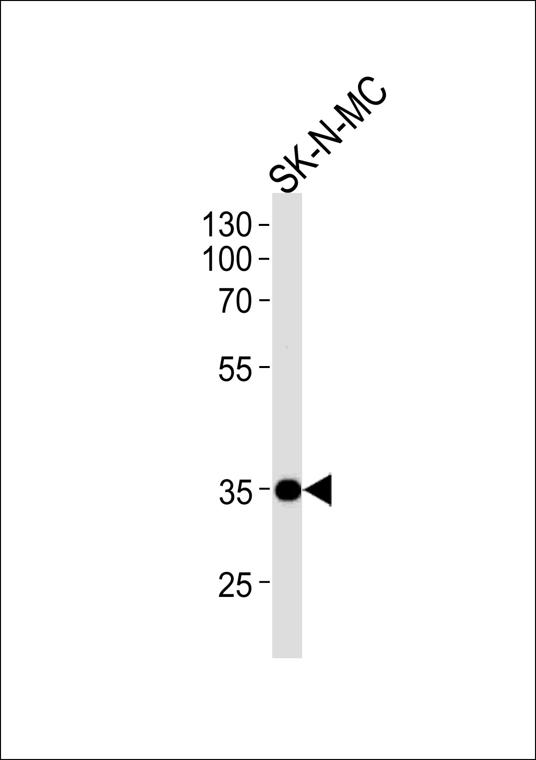 NKX1-1 Antibody (Center) (Cat. #AP11916c) western blot analysis in SK-N-MC cell line lysates (35ug/lane).This demonstrates the NKX1-1 antibody detected the NKX1-1 protein (arrow).