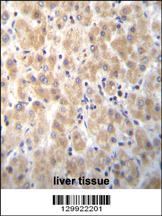 PABPN1L Antibody (Center) (Cat. #AP11914c)immunohistochemistry analysis in formalin fixed and paraffin embedded human liver tissue followed by peroxidase conjugation of the secondary antibody and DAB staining.This data demonstrates the use of PABPN1L Antibody (Center) for immunohistochemistry. Clinical relevance has not been evaluated.