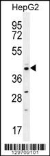 CCNI2 Antibody (Center) (Cat. #AP11897c) western blot analysis in HepG2 cell line lysates (35ug/lane).This demonstrates the CCNI2 antibody detected the CCNI2 protein (arrow).