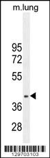 RNF215 Antibody (C-term) (Cat. #AP11895b) western blot analysis in mouse lung tissue lysates (35ug/lane).This demonstrates the RNF215 antibody detected the RNF215 protein (arrow).