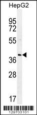 RNF215 Antibody (C-term) (Cat. #AP11895b) western blot analysis in HepG2 cell line lysates (35ug/lane).This demonstrates the RNF215 antibody detected the RNF215 protein (arrow).