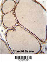 NFKBID Antibody (N-term) (Cat. #AP11893a)immunohistochemistry analysis in formalin fixed and paraffin embedded human thyroid tissue followed by peroxidase conjugation of the secondary antibody and DAB staining.This data demonstrates the use of NFKBID Antibody (N-term) for immunohistochemistry. Clinical relevance has not been evaluated.