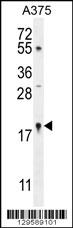 SNR27 Antibody (Center) (Cat. #AP11892c) western blot analysis in A375 cell line lysates (35ug/lane).This demonstrates the SNR27 antibody detected the SNR27 protein (arrow).