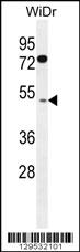 RMD1 Antibody (N-term) (Cat. #AP11887a) western blot analysis in WiDr cell line lysates (35ug/lane).This demonstrates the RMD1 antibody detected the RMD1 protein (arrow).