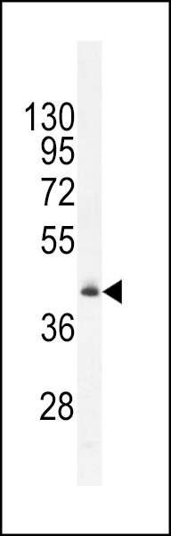 RMD1 Antibody (N-term) (Cat. #AP11887a) western blot analysis in mouse heart tissue lysates (35ug/lane).This demonstrates the RMD1 antibody detected the RMD1 protein (arrow).