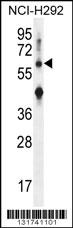 COL13A1 Antibody (N-term) (Cat. #AP11858a) western blot analysis in NCI-H292 cell line lysates (35ug/lane).This demonstrates the COL13A1 antibody detected the COL13A1 protein (arrow).