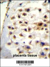 COL13A1 Antibody (N-term) (Cat. #AP11858a)immunohistochemistry analysis in formalin fixed and paraffin embedded human placenta tissue followed by peroxidase conjugation of the secondary antibody and DAB staining.This data demonstrates the use of COL13A1 Antibody (N-term) for immunohistochemistry. Clinical relevance has not been evaluated.