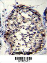 ROPN1L Antibody (N-term) (Cat. #AP11844a)immunohistochemistry analysis in formalin fixed and paraffin embedded human testis tissue followed by peroxidase conjugation of the secondary antibody and DAB staining.This data demonstrates the use of ROPN1L Antibody (N-term) for immunohistochemistry. Clinical relevance has not been evaluated.