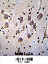 ANKRD34C Antibody (C-term) (Cat. #AP11827b)immunohistochemistry analysis in formalin fixed and paraffin embedded human brain tissue followed by peroxidase conjugation of the secondary antibody and DAB staining.This data demonstrates the use of ANKRD34C Antibody (C-term) for immunohistochemistry. Clinical relevance has not been evaluated.