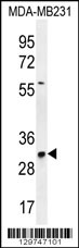 TNFAIP8L3 Antibody (Center) (Cat. #AP11822c) western blot analysis in MDA-MB231 cell line lysates (35ug/lane).This demonstrates the TNFAIP8L3 antibody detected the TNFAIP8L3 protein (arrow).