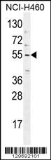 TRIM65 Antibody (Center) (Cat. #AP11814c) western blot analysis in NCI-H460 cell line lysates (35ug/lane).This demonstrates the TRIM65 antibody detected the TRIM65 protein (arrow).