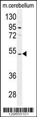 CNGA4 Antibody (N-term) (Cat. #AP11811a) western blot analysis in mouse cerebellum tissue lysates (35ug/lane).This demonstrates the CNGA4 antibody detected the CNGA4 protein (arrow).