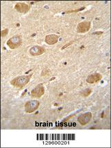 CNGA4 Antibody (N-term) (Cat. #AP11811a)immunohistochemistry analysis in formalin fixed and paraffin embedded human brain tissue followed by peroxidase conjugation of the secondary antibody and DAB staining.This data demonstrates the use of CNGA4 Antibody (N-term) for immunohistochemistry. Clinical relevance has not been evaluated.