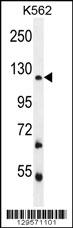 FBRSL1 Antibody (C-term) (Cat. #AP11809b) western blot analysis in K562 cell line lysates (35ug/lane).This demonstrates the FBRSL1 antibody detected the FBRSL1 protein (arrow).