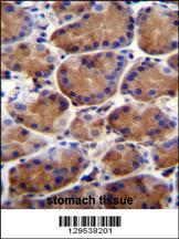 LRWD1 Antibody (N-term) (Cat. #AP11807a)immunohistochemistry analysis in formalin fixed and paraffin embedded human stomach tissue followed by peroxidase conjugation of the secondary antibody and DAB staining.This data demonstrates the use of LRWD1 Antibody (N-term) for immunohistochemistry. Clinical relevance has not been evaluated.