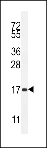 SPACA5 Antibody (Center) (Cat. #AP11801c) western blot analysis in mouse heart tissue lysates (35ug/lane).This demonstrates the SPACA5 antibody detected the SPACA5 protein (arrow).