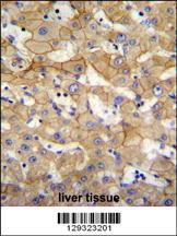 SPACA5 Antibody (Center) (Cat. #AP11801c)immunohistochemistry analysis in formalin fixed and paraffin embedded human liver tissue followed by peroxidase conjugation of the secondary antibody and DAB staining.This data demonstrates the use of SPACA5 Antibody (Center) for immunohistochemistry. Clinical relevance has not been evaluated.