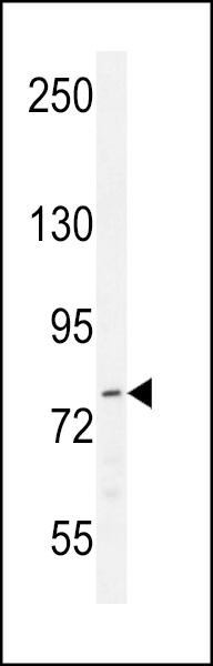 p21WAF1 Antibody (Center H450) (Cat. #AP11778c) western blot analysis in WiDr cell line lysates (35ug/lane).This demonstrates the p21WAF1 antibody detected the p21WAF1 protein (arrow).